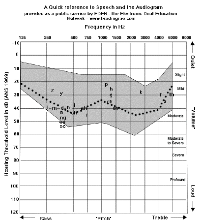 hearing threshold levels