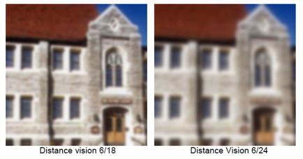 distance vision 6/18