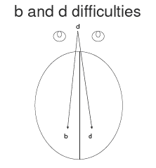 b and d difficulties